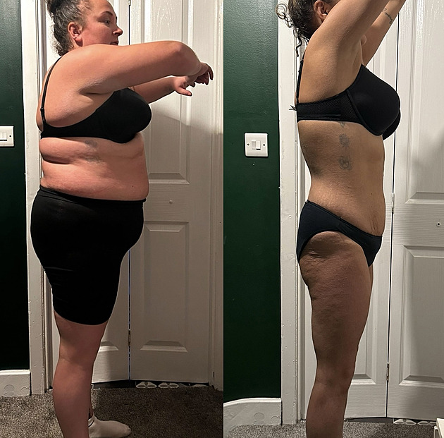 Zhubla desítky kil díky injekcím, vysněná postava ji ale stála vlasy